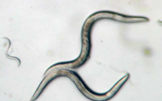 Szívférgesség: a fonálféreg számára az ember nem a megfelelő gazda