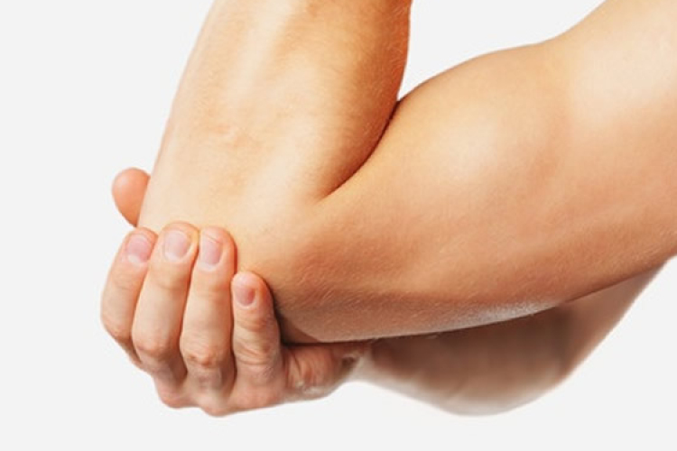 Ízületi gyulladás (arthritis) - A legfontosabb tudnivalók